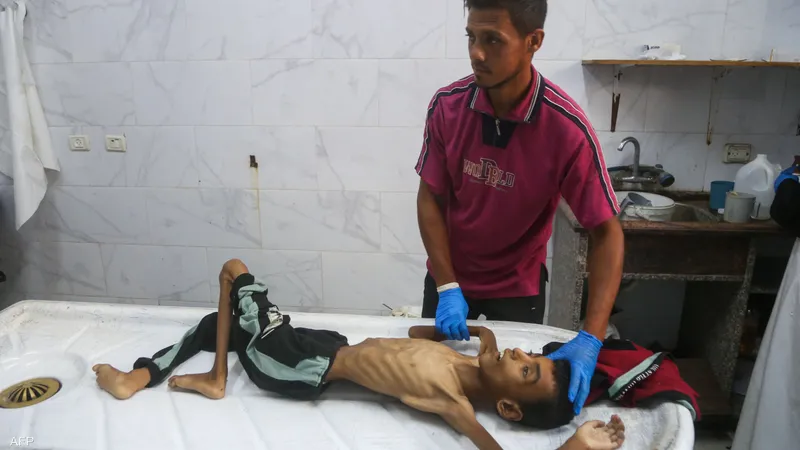 “الشلل الرخو الحاد” يصيب العشرات في غزة.. ما هو؟