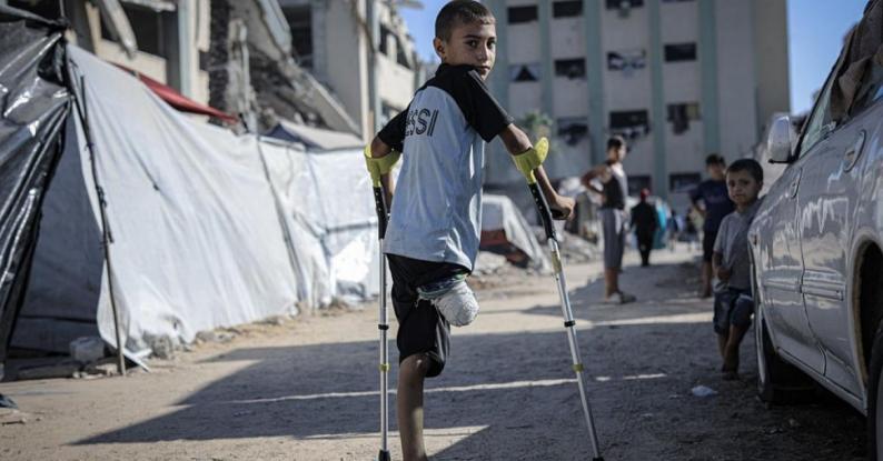 الأمم المتحدة: غزة تسجّل أعداداً غير مسبوقة من الأطفال مبتوري الأطراف بسبب مخلفات الحرب